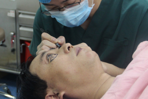 2020金昌市中西醫(yī)結(jié)合醫(yī)院眼科整形價(jià)格表(價(jià)目表)全新發(fā)布