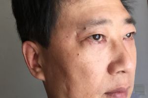 2020楚雄州人民醫(yī)院眼科整形價(jià)格表(價(jià)目表)全新發(fā)布