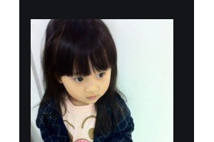 25歲以上不同部位除皺方法