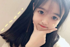 上海二醫(yī)大附屬第九人民醫(yī)院整形激光美容中心劉偉整形價(jià)格表附激光美容案例展示