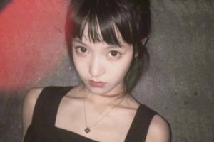 北京畫美醫(yī)院整形美容科（原長虹醫(yī)院）斯日古楞整形價格表附抗衰老案例展示