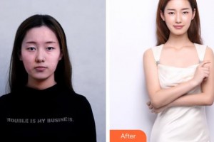 上海華美醫(yī)療美容醫(yī)院田波整形價格表附法國青春動能素補水嫩膚，除皺案例展示