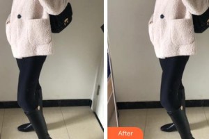 上海美立方整形醫(yī)院金洙喆整形價(jià)格表附吸脂·大腿吸脂案例展示