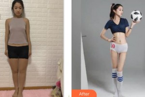 上海德琳醫(yī)療美容醫(yī)院金成德整形價(jià)格表附腰腹環(huán)吸+大小腿吸脂案例展示