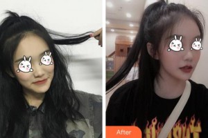 上海天大醫(yī)療美容醫(yī)院盧京鉉整形價(jià)格表附無針?biāo)獍咐故?>
</a>
<h3 class=