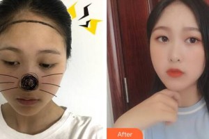 廣州樂鬢毛發(fā)移植中心計斌整形價格表附發(fā)際線案例展示