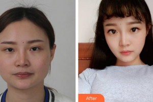 上海天大醫(yī)療美容醫(yī)院熊俊文整形價(jià)格表附頜面整形案例展示