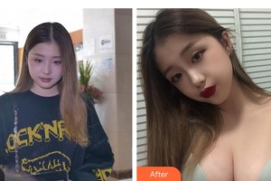 上海麗人整形美容醫(yī)院朱昌整形價(jià)格表附假體隆胸案例展示