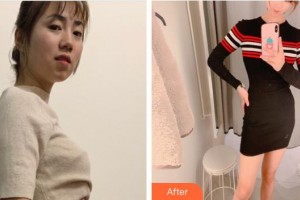 上?？祳W醫(yī)療美容醫(yī)院何玉成整形價格表附光子套餐案例展示