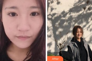 上海玫瑰醫(yī)療美容醫(yī)院吳曉麗整形價格表附無針?biāo)獍咐故?>
</a>
<h3 class=