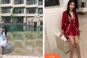 廣州軍頤醫(yī)院整形美容中心崔菲菲整形價格表附白瓷娃娃案例展示