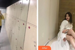 廣州軍美整形醫(yī)院王世虎整形價格表附吸脂瘦腰腹案例展示