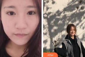 廣州軍頤醫(yī)院整形美容中心石建薇整形價格表附無針?biāo)獍咐故?>
</a>
<h3 class=