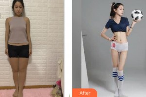 上海閔行區(qū)中醫(yī)院整形外科盧九寧整形價格表附腰腹環(huán)吸+大小腿吸脂案例展示