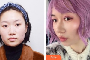 上海藝星醫(yī)療美容醫(yī)院姜敏赫整形價格表附埋線雙眼皮+去脂案例展示