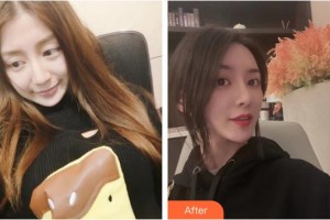 上海比華利整形醫(yī)院劉姝娟主治醫(yī)生整形價(jià)格表附鼻修復(fù)+鼻部手術(shù)案例展示