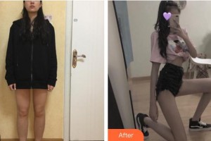 上海韓仕醫(yī)療美容門診部沈鶯鶯整形價(jià)格表附大腿吸脂案例展示