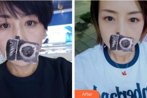 上海清楊整形外科門診部張濱整形價(jià)格表附祛眼袋案例展示