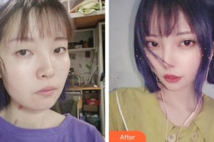 上海瑞麗整形美容醫(yī)院安健榮整形價(jià)格表附【水氧活膚】皮膚清潔補(bǔ)水嫩膚案例展示