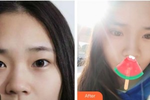 上海吳月蘭整形外科診所吳月蘭整形價(jià)格表附全切雙眼皮案例展示