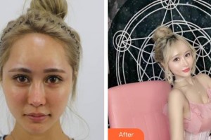 上海辰新醫(yī)院醫(yī)學(xué)美容科楊希鏸整形價(jià)格表附酒窩案例展示