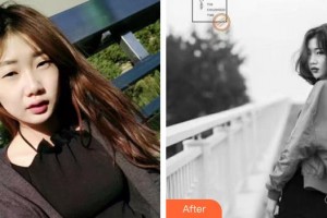 上海市紅十字眼耳鼻喉醫(yī)院整形外科胡文明整形價(jià)格表附眼部綜合案例展示