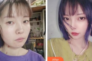 上?，旣愥t(yī)院整形美容中心李云天主診醫(yī)師整形價(jià)格表附皮膚清潔補(bǔ)水嫩膚案例展示