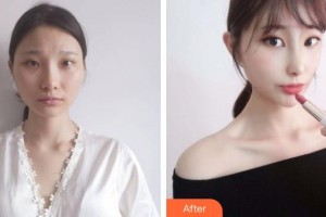 上海陳翌農(nóng)醫(yī)療美容診所陳翌農(nóng)整形價(jià)格表附面部吸脂案例展示