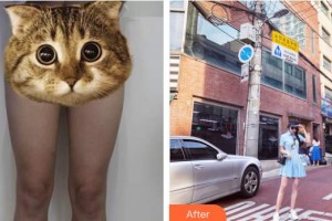 上海新星醫(yī)療美容整形外科吳坤南整形價(jià)格表附全身吸脂+面吸案例展示