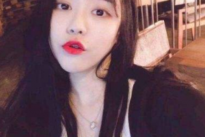 北京加減美整形門診部李紅敏整形價(jià)格表附金屬托槽矯正案例展示