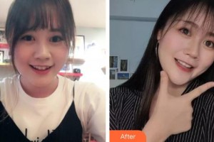 上海顏夢醫(yī)療美容門診部楊璐整形價格表附眼部手術(shù)案例展示