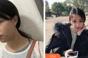 上海百達(dá)麗醫(yī)療美容醫(yī)院談?dòng)铗v整形價(jià)格表附切開雙眼皮案例展示