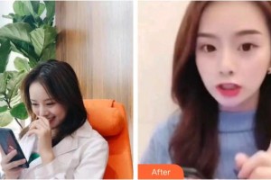 上海原辰醫(yī)療美容醫(yī)院梁在鎮(zhèn)整形價(jià)格表附面部吸脂案例展示