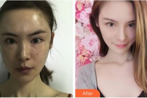 上海天大醫(yī)療美容醫(yī)院高榮敏整形價(jià)格表附【抗衰嫩膚】案例展示