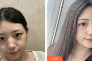 上海保加醫(yī)療美容門診部張英整形價(jià)格表附激光祛斑案例展示