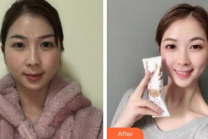 上海伯思立醫(yī)療美容門診部馬文容整形價格表附多方面部激光美膚祛斑案例展示