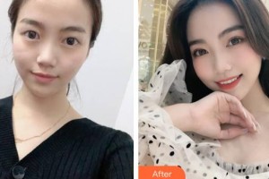 武警上?？傟犪t(yī)院整形美容中心游萬福整形價格表附無針?biāo)獍咐故?>
</a>
<h3 class=