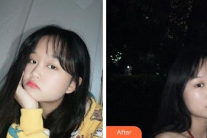 武警上?？傟犪t(yī)院整形美容中心朱麗倩整形價格表附光子嫩膚案例展示