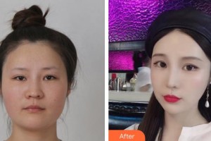 上海新健威醫(yī)療美容門診部宋安堂整形價格表附頜面整形案例展示