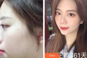 上海伊萊美醫(yī)療美容醫(yī)院王海鑫整形價(jià)格表附牙齒矯正案例展示