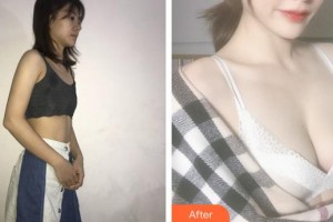 上海博愛醫(yī)院整形科高健整形價(jià)格表附假體隆胸案例展示