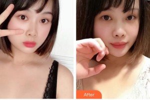 上海伊萊美醫(yī)療美容醫(yī)院張余光整形價(jià)格表附胸部整形案例展示