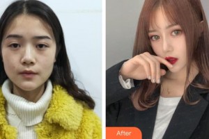 上海凱渥醫(yī)療美容門診部陳小萱整形價格表附美鼻部手術案例展示