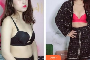 上海明慨醫(yī)療美容門診部王亮整形價(jià)格表附濃縮豐胸真實(shí)案例展示