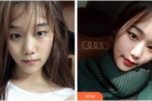 上海芙艾醫(yī)療美容門診部張桂蓉整形價(jià)格表附光子嫩膚案例展示