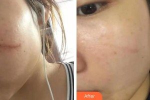 醫(yī)療美容門診部丁曉東整形價(jià)格表附祛疤案例展示