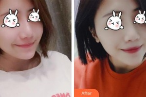 醫(yī)療美容門診部熊師整形價(jià)格表附無針?biāo)獍咐故?>
</a>
<h3 class=