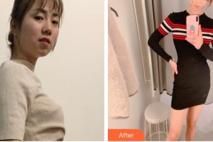 上海萬安醫(yī)療美容醫(yī)院馬晶波整形價(jià)格表附光子套餐案例展示