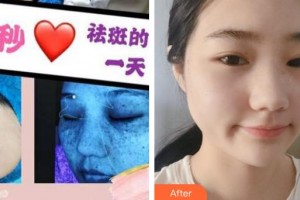 上海百達(dá)麗醫(yī)療美容醫(yī)院王耀萍整形價(jià)格表附超激光美膚祛斑案例展示