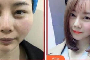 上海百達(dá)麗醫(yī)療美容醫(yī)院蔡敏整形價(jià)格表附美白祛斑案例展示